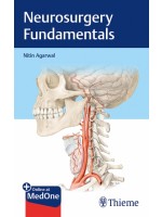 Neurosurgery Fundamentals