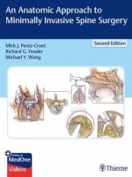 An Anatomic Approach to Minimally Invasive Spine Surgery