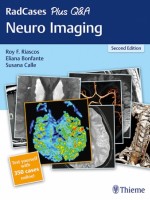 RadCases Plus Q&A Neuro Imaging