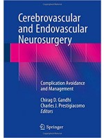 Cerebrovascular and Endovascular Neurosurgery