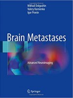 Brain Metastases: Advanced Neuroimaging