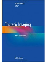 Thoracic Imaging: Basic to Advanced