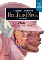 Diagnostic Ultrasound: Head and Neck, 2e