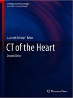 CT of the Heart (Contemporary Medical Imaging) 2nd Edition
