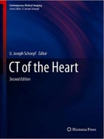 CT of the Heart (Contemporary Medical Imaging) 2nd Edition