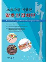 초음파를 이용한 말초신경차단