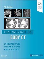 Fundamentals of Body CT 5e