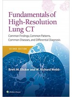 Fundamentals of High-Resolution Lung CT, 2e