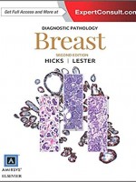 Diagnostic Pathology: Breast, 2e