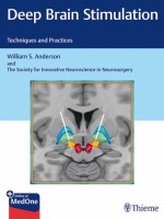 Deep Brain Stimulation Techniques and Practices