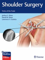 Shoulder Surgery Tricks of the Trade