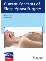 Current Concepts of Sleep Apnea Surgery