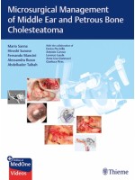 Microsurgical Management of Middle Ear and Petrous Bone Cholesteatoma