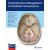 Comprehensive Management of Vestibular Schwannoma