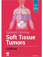 Diagnostic Pathology: Soft Tissue Tumors, 3e