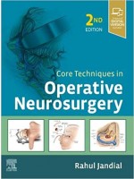 Core Techniques in Operative Neurosurgery, 2e