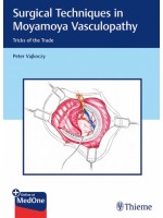 Surgical Techniques in Moyamoya Vasculopathy