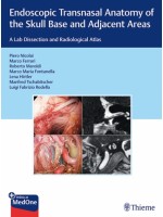 Endoscopic Transnasal Anatomy of the Skull Base and Adjacent Areas