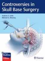 Controversies in Skull Base Surgery