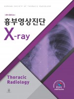 흉부영상진단 X-ray 4판