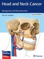 Head and Neck Cancer: Management and Reconstruction, 2e