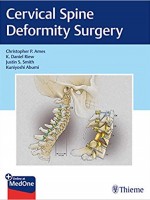 Cervical Spine Deformity Surgery