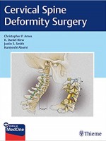 Cervical Spine Deformity Surgery