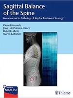 Sagittal Balance of the Spine
