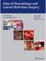 Atlas of Neurotology and Lateral Skull Base Surgery