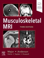 Musculoskeletal MRI, 3e