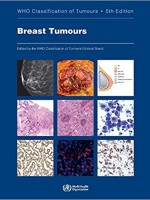 Breast Tumours