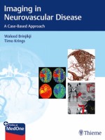 Imaging in Neurovascular Disease
