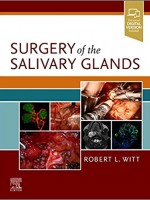 Surgery of the Salivary Glands