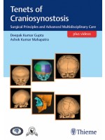 Tenets of Craniosynostosis: Surgical Principles and Advanced Multidisciplinary Care