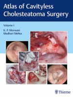 Atlas of Cavityless Cholesteatoma Surgery (Volume 1)