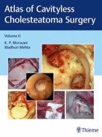Atlas of Cavityless Cholesteatoma Surgery (Volume 2)