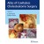 Atlas of Cavityless Cholesteatoma Surgery (Volume 2)