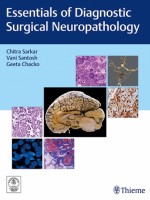 Essentials of Diagnostic Surgical Neuropathology