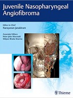 Juvenile Nasopharyngeal Angiofibroma