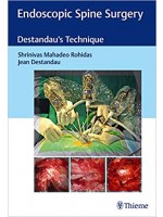 Endoscopic Spine Surgery Destandau's Technique