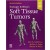 Enzinger and Weiss's Soft Tissue Tumors, 7e