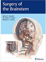 Surgery of the Brainstem