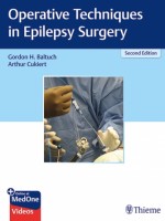 Operative Techniques in Epilepsy Surgery, 2e