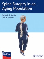 Spine Surgery in an Aging Population