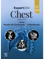 ExpertDDx: Chest, 2e