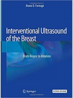 Interventional Ultrasound of the Breast: From Biopsy to Ablation