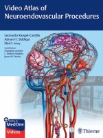 Video Atlas of Neuroendovascular Procedures