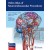 Video Atlas of Neuroendovascular Procedures