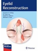 Eyelid Reconstruction