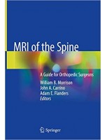 MRI of the Spine: A Guide for Orthopedic Surgeons